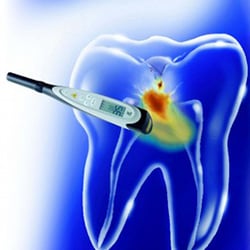 K C Sykora, DDS - Diagnodent laser technology aids in the detection of decay often before we can even detect it with the dreaded pick...