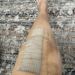 Arrowhead Orthopaedics Physical Therapy