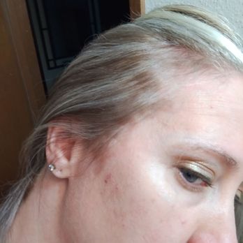 Sunrise Salon - Here is another pic of the other side where she left die all over my scalp and skin. - Hair Salons Near Me - Gresham, Oregon Sunrise Salon - Here is another pic of the other side where she left die all over my scalp and skin. - Hair Salons Near Me - Gresham, Oregon