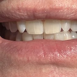 Gulfside Dental & Orthodontics - Galveston - Clean teef!! LOL #teeth
