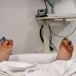 Massachusetts General Hospital - About six days after I was neglected and abruptly discharged from Encompass Rehabilitation hospital in Concord NH .