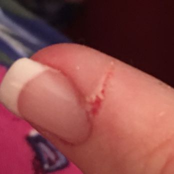 Borgata Nail Salon - Finger cut during manicure. - Nail Salons Near Me - Houston, Texas Borgata Nail Salon - Finger cut during manicure. - Nail Salons Near Me - Houston, Texas
