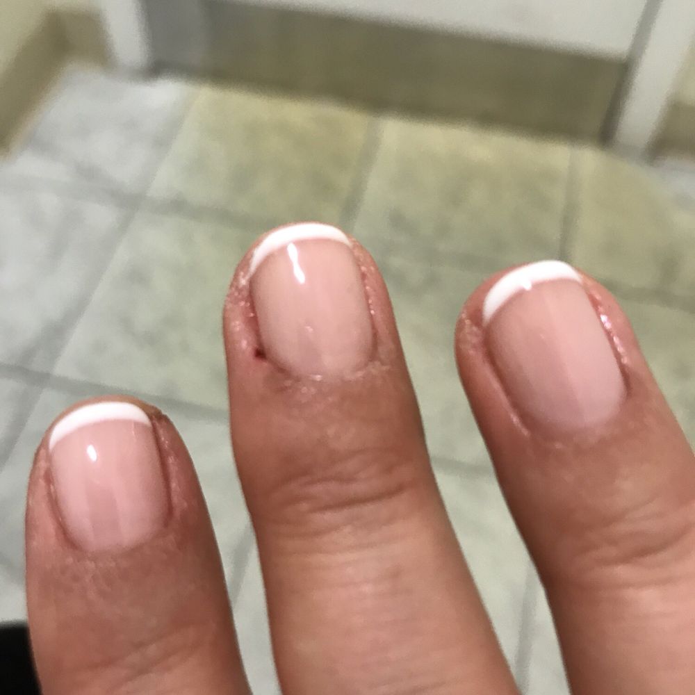 Choice Nails - I was bleeding yesterday during my manicure as they cut too much into my cuticle. Ouch! - Nail Salons Near Me - Palatine, Illinois