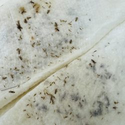 Lousey Day Lice Help - Lots of nits(eggs) and bugs!