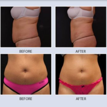 Uplifting Medi Spa - Laser Hair Removal Near Me - New Braunfels, Texas Uplifting Medi Spa - Laser Hair Removal Near Me - New Braunfels, Texas