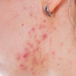 High Valley Dermatology