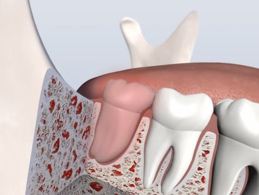 Associates in Maxillofacial & Oral Surgery