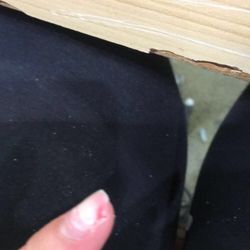 Professionail - Tore off my real nail thinking it was acrylic