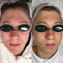 Photo of Face Five Acne Clinic
