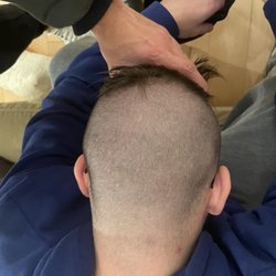 Practically bald.. where's the fade !?