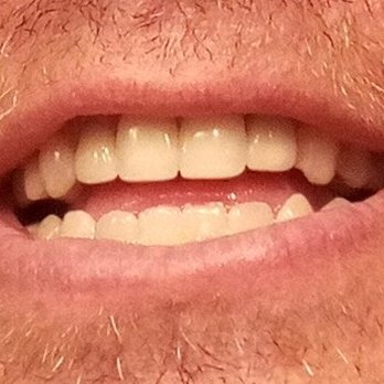 Universal Dental Smiles - General Dentistry Near Me - San Diego, California Universal Dental Smiles - General Dentistry Near Me - San Diego, California