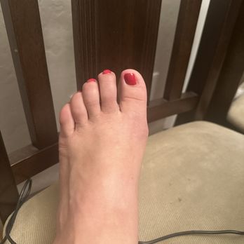 Model Nails - Cute toes, disregard the swollen foot and ankle - Nail Salons Near Me - Sacramento, California