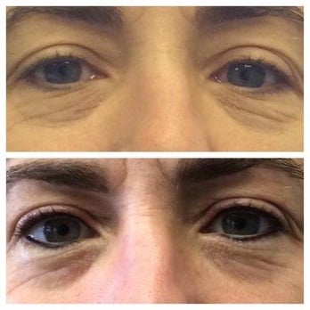 Sola Salon Studios - Before and immediately after upper and lower eyeliner. - Shared Office Spaces Near Me - Irvine, California Sola Salon Studios - Before and immediately after upper and lower eyeliner. - Shared Office Spaces Near Me - Irvine, California