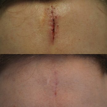 Carniol Plastic Surgery - Plastic Surgeons Near Me - Summit, New Jersey