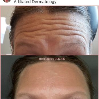 Affiliated Dermatology - N 27th Ave - Dermatologists Near Me - Phoenix, Arizona Affiliated Dermatology - N 27th Ave - Dermatologists Near Me - Phoenix, Arizona