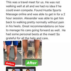 Holistic Muscle Therapy - Severs disease fix