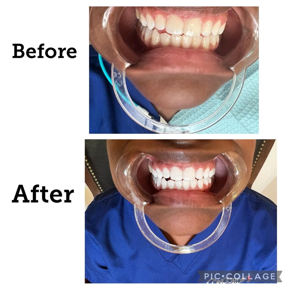 Blanc Smilee Logo