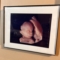Eclipse 4D Mobile Ultrasounds
