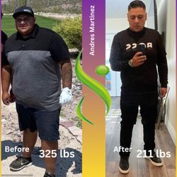 SD Weight Loss Center - Andres Martinez's incredible transformation with SD Weight Loss Center.