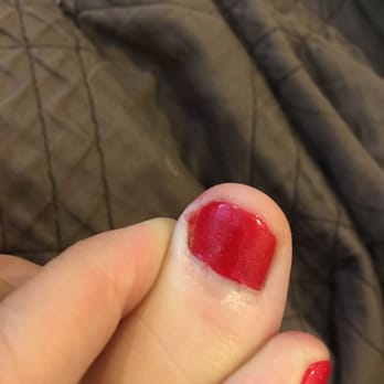Ken Nails Spa - Deep cut on the inside of my toe - Nail Salons Near Me - Dublin, California Ken Nails Spa - Deep cut on the inside of my toe - Nail Salons Near Me - Dublin, California