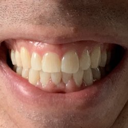 Blue Sky Dental Care - Smiles and Clean Teeth are Always in Fashion at Blue Sky Dental.