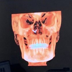 Becher & Gil Orthodontics - I am terrifying