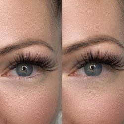 J. Elite Esthetics