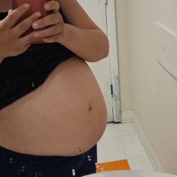 Miracle View 3D/4D Ultrasound - Obstetricians & Gynecologists Near Me - Phoenix, Arizona Miracle View 3D/4D Ultrasound - Obstetricians & Gynecologists Near Me - Phoenix, Arizona
