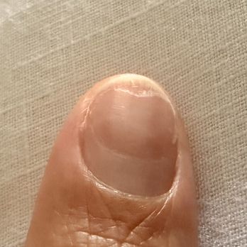 Happiest Nails & Spa - Growing out but will take a long time to get rid of the damage. - Nail Salons Near Me - Oceanside, California