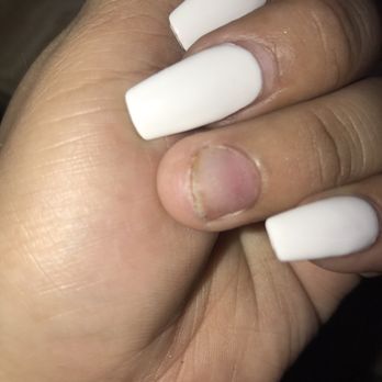 Perfect Nails - Nasty fungus - Nail Salons Near Me - Norcross, Georgia Perfect Nails - Nasty fungus - Nail Salons Near Me - Norcross, Georgia