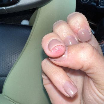 Mimosa Nails And Spa - Where the owner filled my skin enough to cause bleeding. - Nail Salons Near Me - Mount Pleasant, South Carolina Mimosa Nails And Spa - Where the owner filled my skin enough to cause bleeding. - Nail Salons Near Me - Mount Pleasant, South Carolina