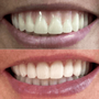 All Valley Dental