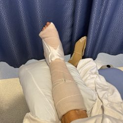 Affinity Surgery Center - Foot fusion.