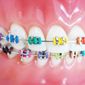 Reese Orthodontics - Orthodontists Near Me - Portland, Oregon Reese Orthodontics - Orthodontists Near Me - Portland, Oregon