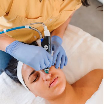 Bare Complexion - Hydrafacial Treatment - Skin Care Near Me - Ventura, California