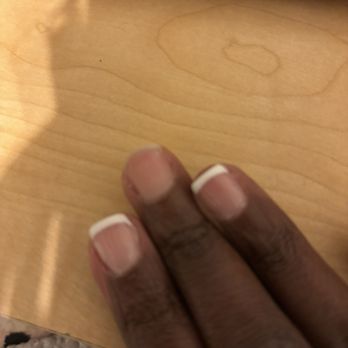 Onyx Nails - Nail fell off. - Nail Salons Near Me - National City, California Onyx Nails - Nail fell off. - Nail Salons Near Me - National City, California