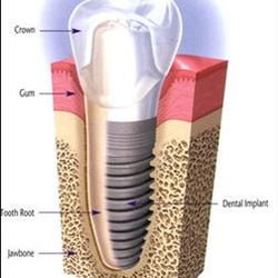 Broomall Dental Health