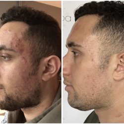 Face It Spa - Face It = Results