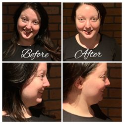 IL Bacio at Benton Square - Oxygen face treatment.