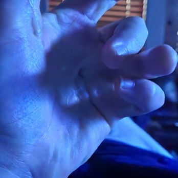 White Glove Storage & Delivery - Photo of my crippled hand... ghis is Straight. - Movers Near Me - Austin, Texas White Glove Storage & Delivery - Photo of my crippled hand... ghis is Straight. - Movers Near Me - Austin, Texas