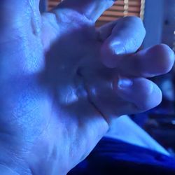White Glove Storage & Delivery - Photo of my crippled hand... ghis is Straight.
