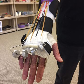 2 Thumbs Up Hand Therapy - Custom Dynamic extension splint for arthritis joint replacements. - Physical Therapy Near Me - Norwell, Massachusetts 2 Thumbs Up Hand Therapy - Custom Dynamic extension splint for arthritis joint replacements. - Physical Therapy Near Me - Norwell, Massachusetts