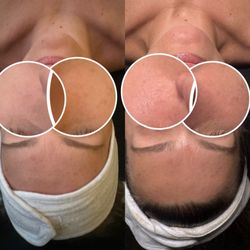 Susan Eyebrow Threading and Waxing - Hydrating Facial - Before & After