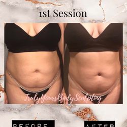 Truly Yours Body Sculpting