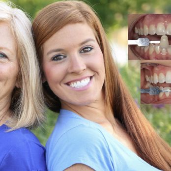 The Whitening Shop - A stunning smile is an invaluable asset. Bright, white teeth can help make you look more youthful, attractive, and confident. - Teeth Whitening Near Me - Virginia Beach, Virginia The Whitening Shop - A stunning smile is an invaluable asset. Bright, white teeth can help make you look more youthful, attractive, and confident. - Teeth Whitening Near Me - Virginia Beach, Virginia
