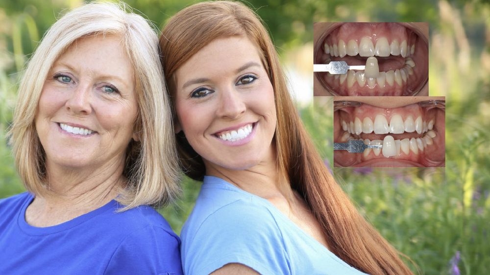 THE WHITENING SHOP 28 Photos 312 Laskin Rd, Virginia Beach