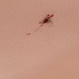 Busy killing mosquitos on my vacation hotel Daniel Busy killing mosquitos on my vacation hotel Daniel