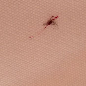 Hotel Danieli, Venice - Busy killing mosquitos on my vacation hotel Daniel - Hotels Near Me - Venezia, VE Hotel Danieli, Venice - Busy killing mosquitos on my vacation hotel Daniel - Hotels Near Me - Venezia, VE