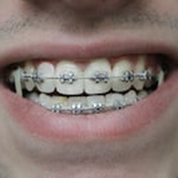 Swonke Dentistry - Affordable braces and dental financing with Orthodontist Dr. Pat Swonke on Louetta near Champions and Vintage Park - General Dentistry Near Me - Spring, Texas Swonke Dentistry - Affordable braces and dental financing with Orthodontist Dr. Pat Swonke on Louetta near Champions and Vintage Park - General Dentistry Near Me - Spring, Texas
