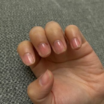 Sally's Spa - Nail removal - Nail Salons Near Me - Burlingame, California Sally's Spa - Nail removal - Nail Salons Near Me - Burlingame, California